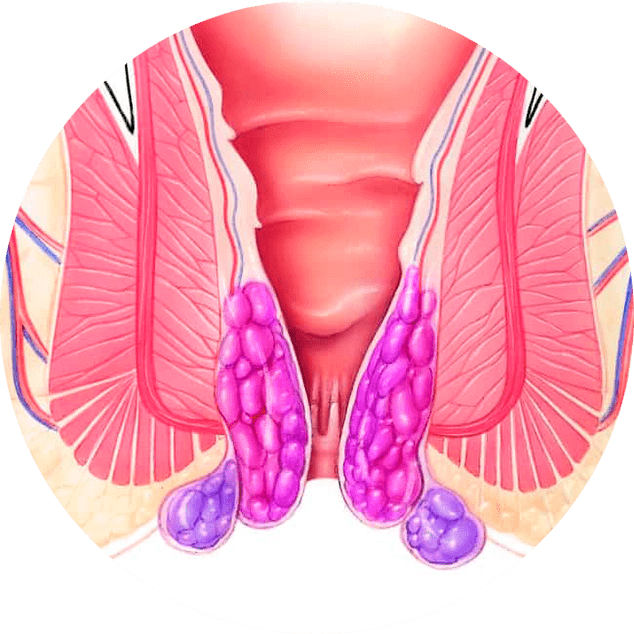 Gelarex ameliorează simptomele de la prima utilizare